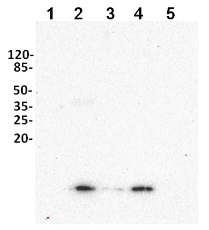 Western blot using anti-ubiqutin antibodies